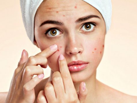 Cómo cuidar la piel propensa al acné - Hechos y mitos sobre el acné